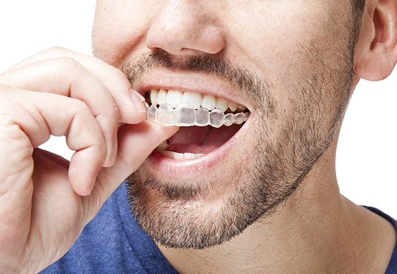 invisalign-image-logo